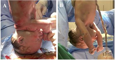 The Newborn's Reaction to Light as the Determinant of the Brain's Activation at Human Birth